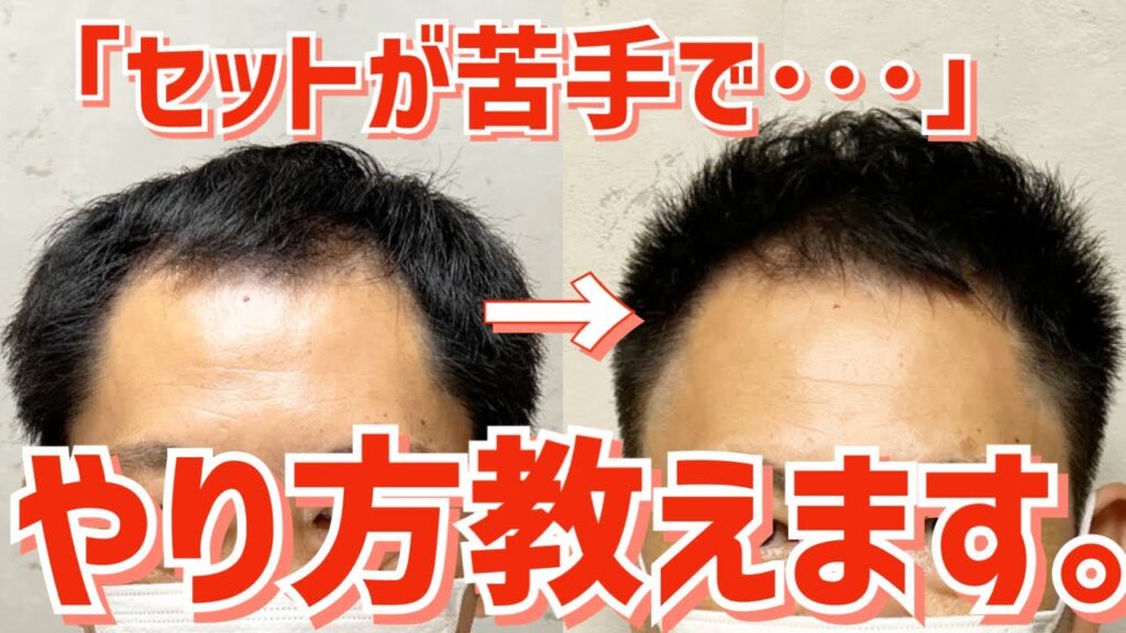 【M字はげ】薄毛をヘアスタイルでカバーするセット術