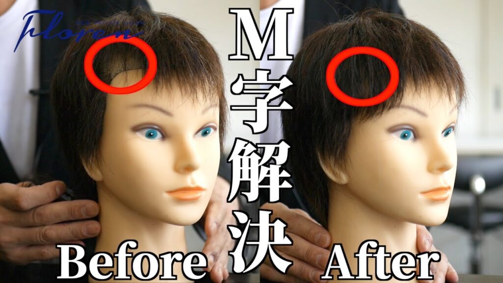 前髪ウィッグでM字ハゲ解決!部分ウィッグでリーズナブルに印象を変える