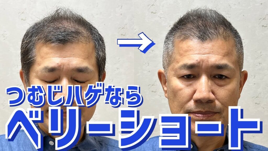 【薄毛】頭頂部ハゲを解決するヘアスタイル