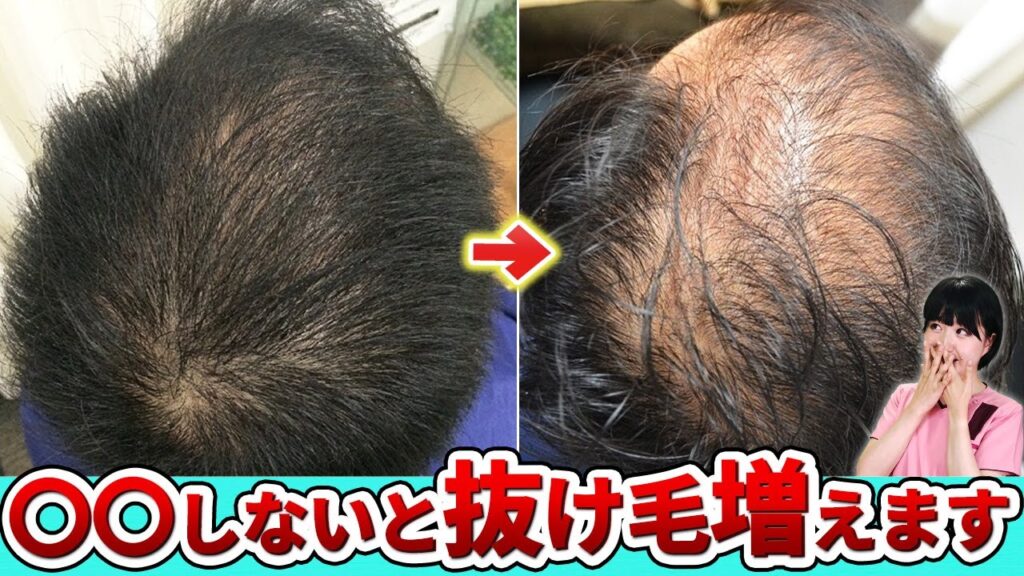 【必ず見て】夏の抜け毛の原因と対策を学び薄毛を改善しましょう！