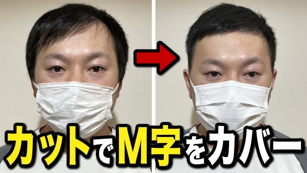 【薄毛】M字ハゲを目立たなくするカット術