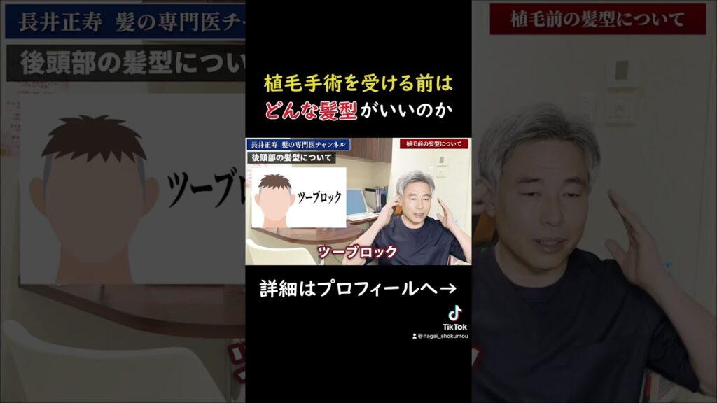 【ご注意】植毛前の後頭部の髪の毛は長いほうがいいです「理由も解説」#shorts