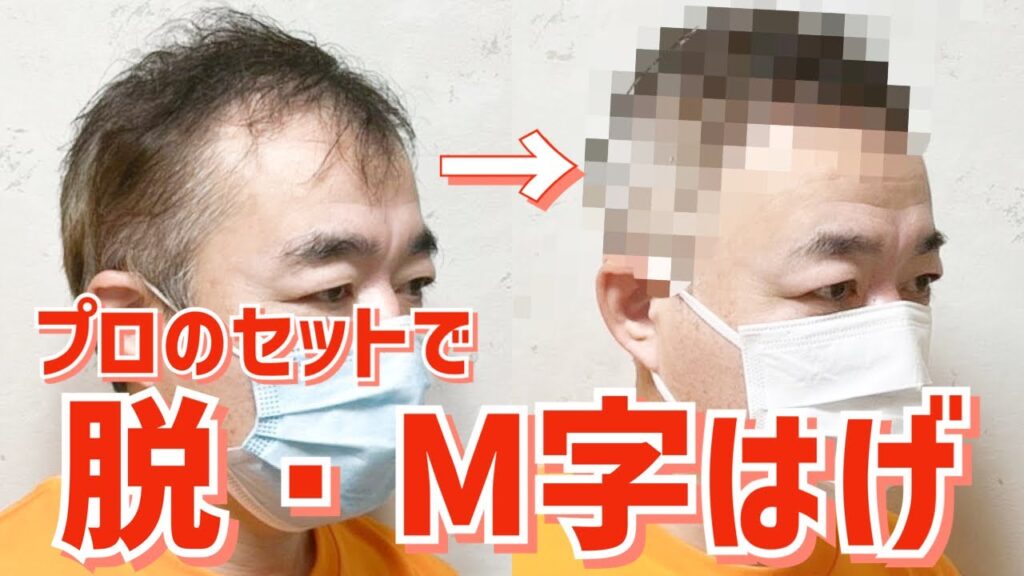 【薄毛】M字はげをセットでカバーするヘアスタイル