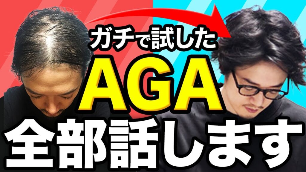 【薄毛改善 永久保存版】忖度なし!案件なし!40歳男性のAGA闘病記ハゲしく語ります。人類はハゲに勝った!