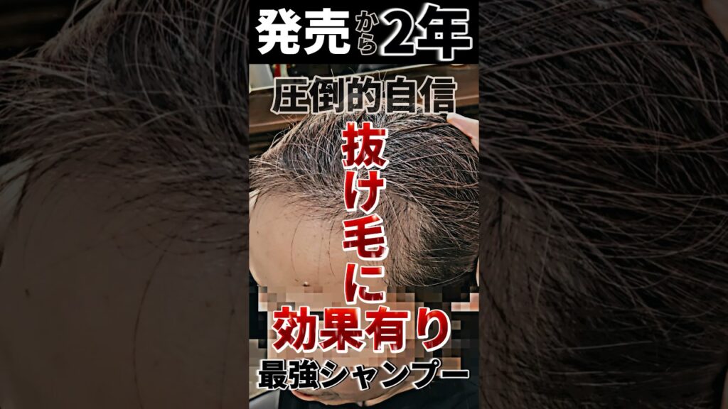 育毛シャンプー 男性 おすすめはアナタシャンプー!薄毛抜け毛に!AGA対策をしよう!#shorts