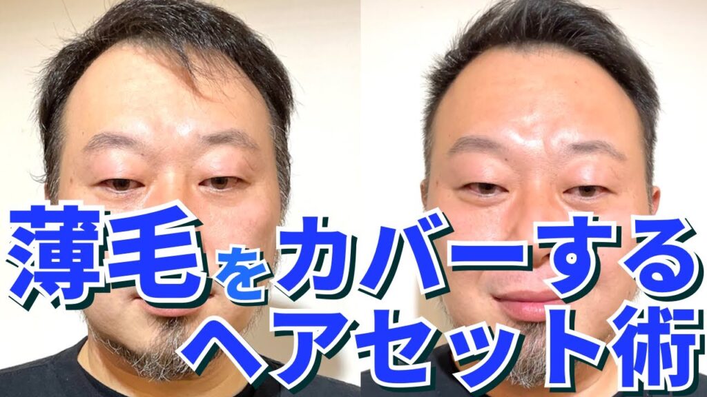 【M字ハゲ】薄毛を目立たなくするヘアセット術