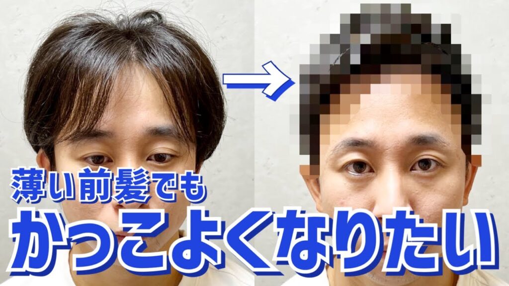 【M字はげ】おでこが広がり透け感のある前髪をカバーするカット術