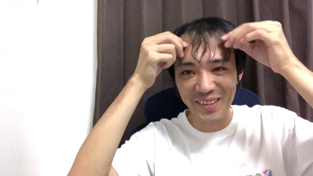 育毛！たく毛！増毛！髪の毛甦れ(。-ω-)zzz. . . (。ﾟωﾟ) ﾊｯ!　ケフトルEX アミノシャンプー