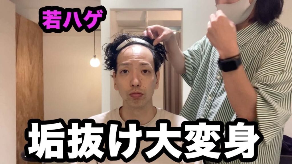 【髪の毛】若ハゲが高級人毛ウィッグで大変身してみた