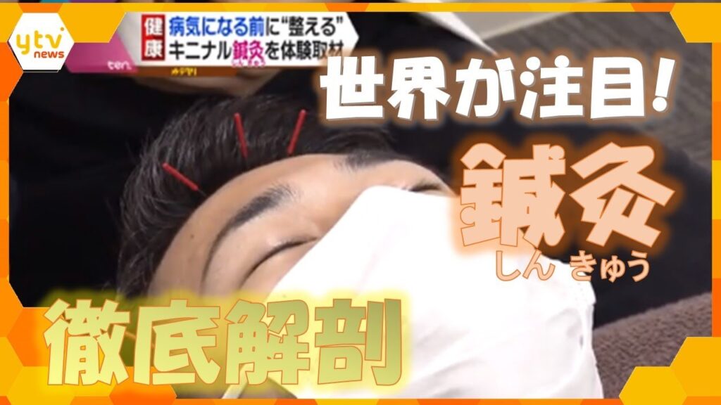 世界が注目「鍼灸(しんきゅう)」WHOも推奨する「伝統医学」を徹底解剖!