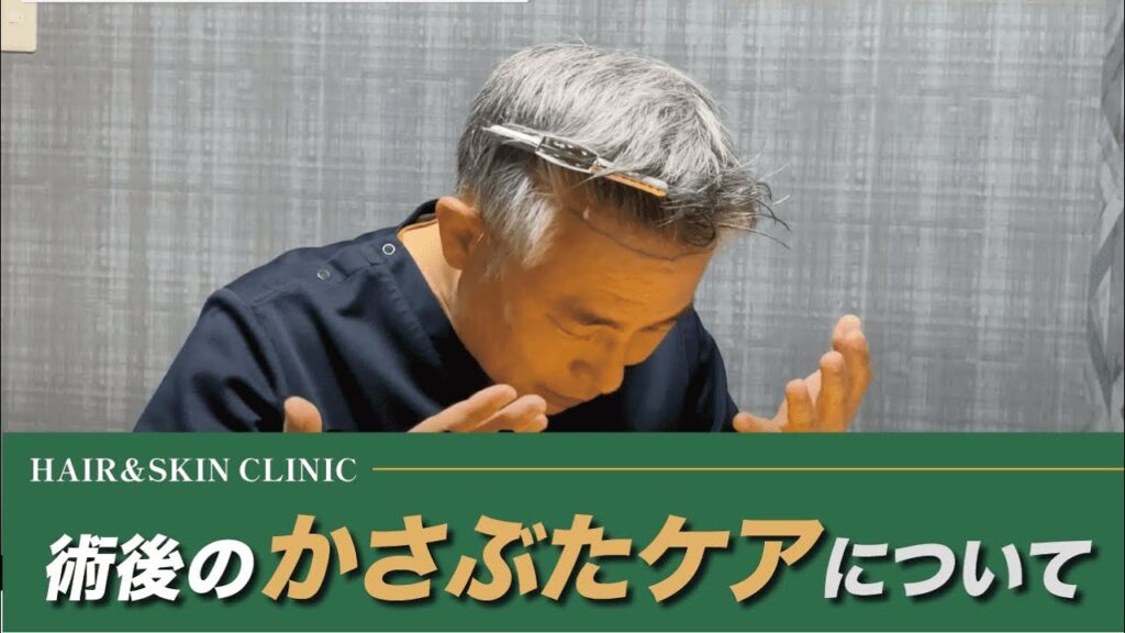 【自毛植毛】術後のかさぶたケアについて（改訂版）