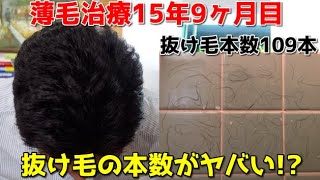 【薄毛治療15年9ヶ月目】最近抜け毛がひどい・・・大丈夫??