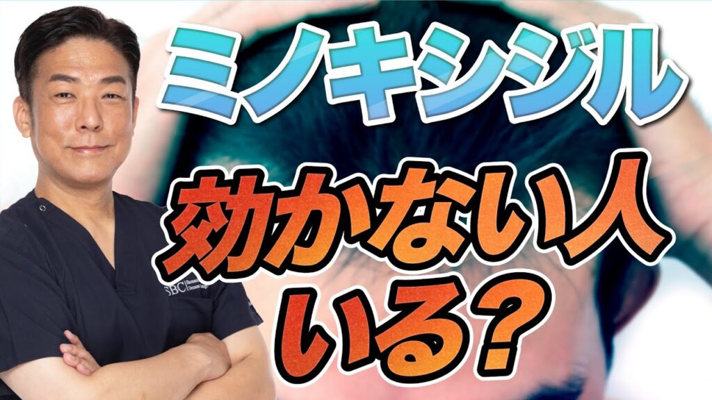 ミノキシジルが効かない人っているの？