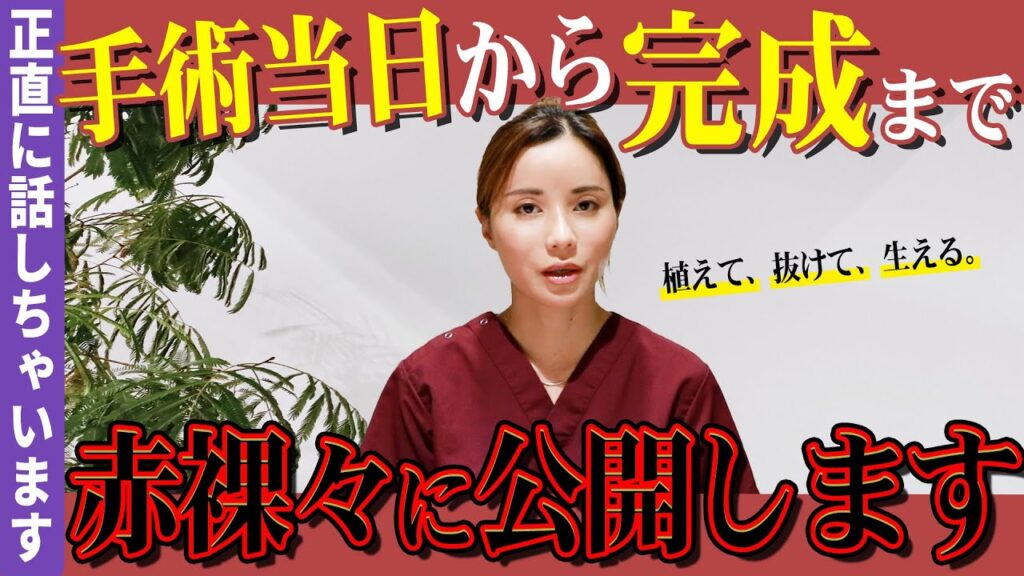 【自毛植毛】手術から1年経過までの流れを解説【薄毛】【AGA治療】