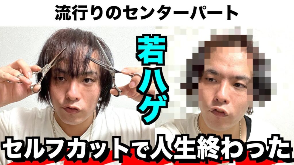 若ハゲがセルフカットで人生終わりました