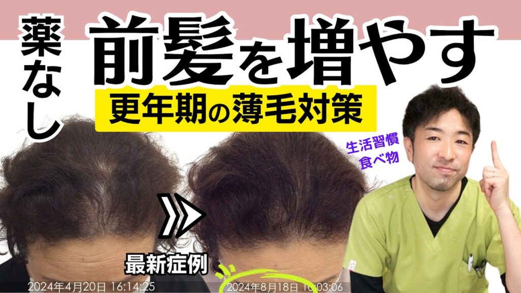 【50代女性発毛症例】更年期の薄毛対策セルフケア〈自律神経ケア&論文ありのお勧め食品〉