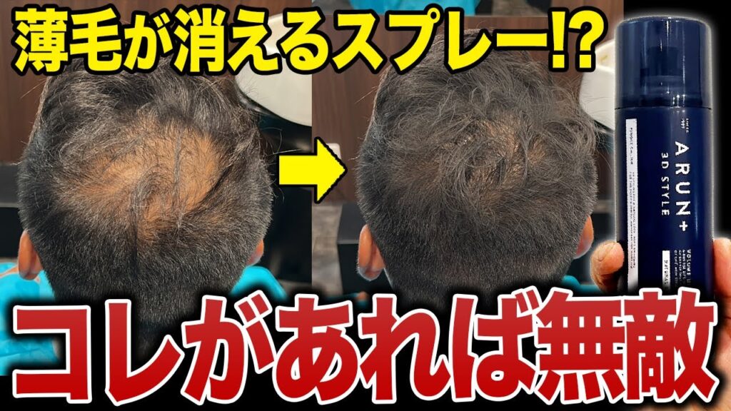 【M字ハゲ・頭頂部の薄毛】増毛スプレーを使った理想のヘアセット！