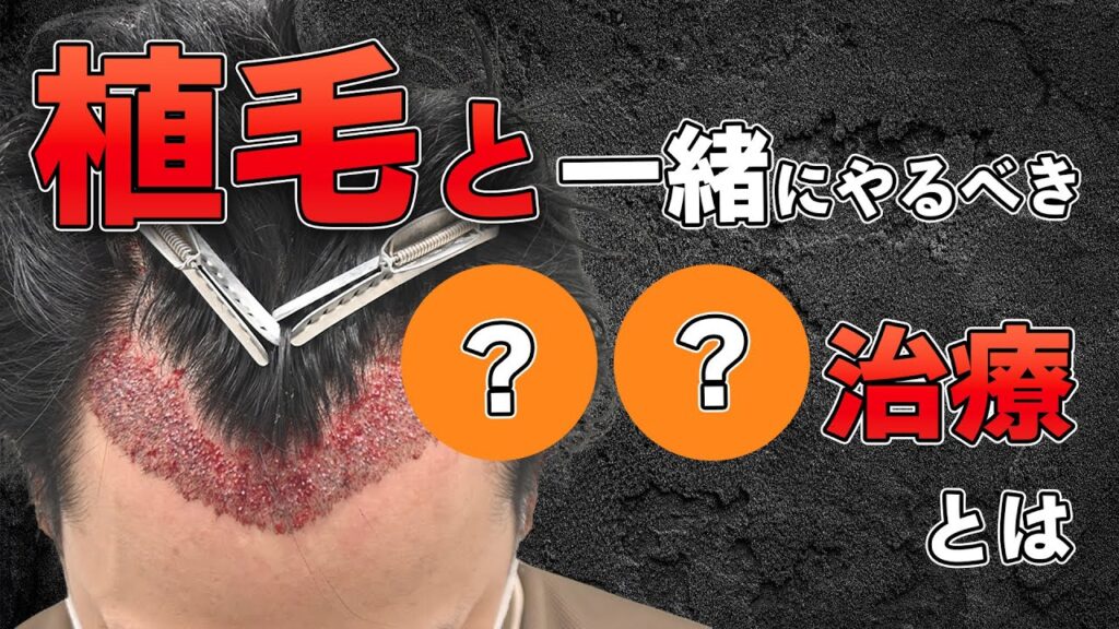 【失敗する前に】植毛手術と併用すべきおすすめ治療