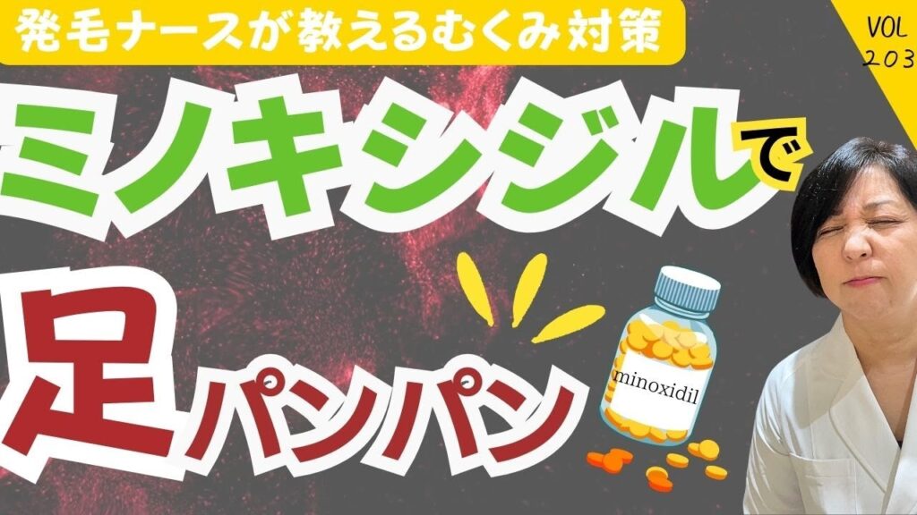 薄毛治療　ミノキシジルの恐ろしすぎた副作用　Aozora/203