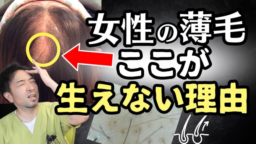 【辛口】女性の薄毛改善は〇〇〇を辞めない限り…正直難しいです
