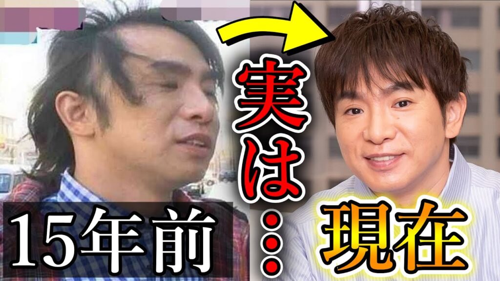 濱口優がハゲを克服！その意外な方法とは？