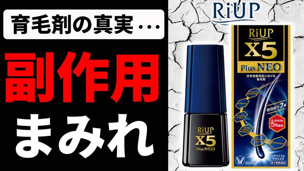 【悲報】ミノキシジルの副作用がヤバすぎる件。