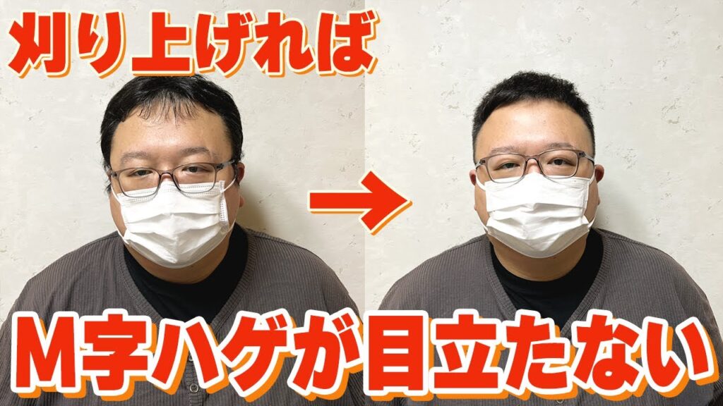前髪の長さに合わせて横を刈り上げるとM字は目立たなくなる！切る長さの決め方などを解説