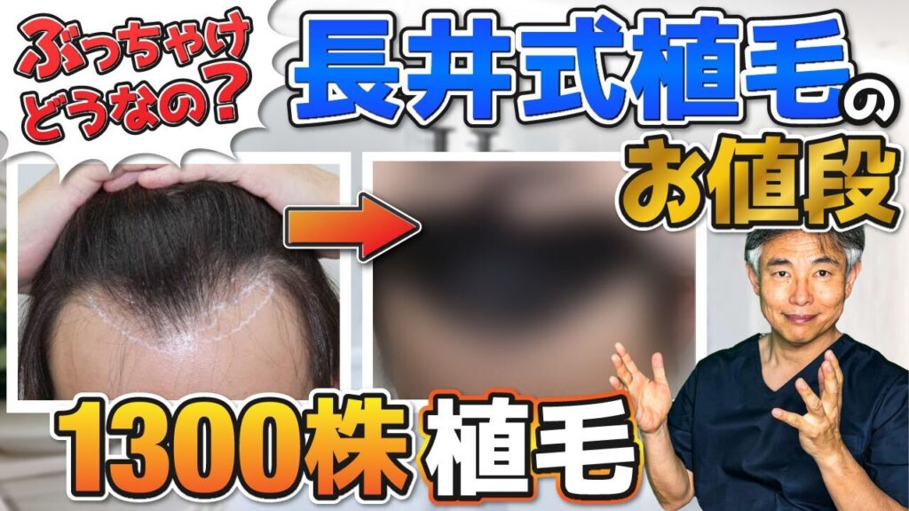 【YouTube初公開】～万円でできる！世界最高水準の長井式植毛のお値段①