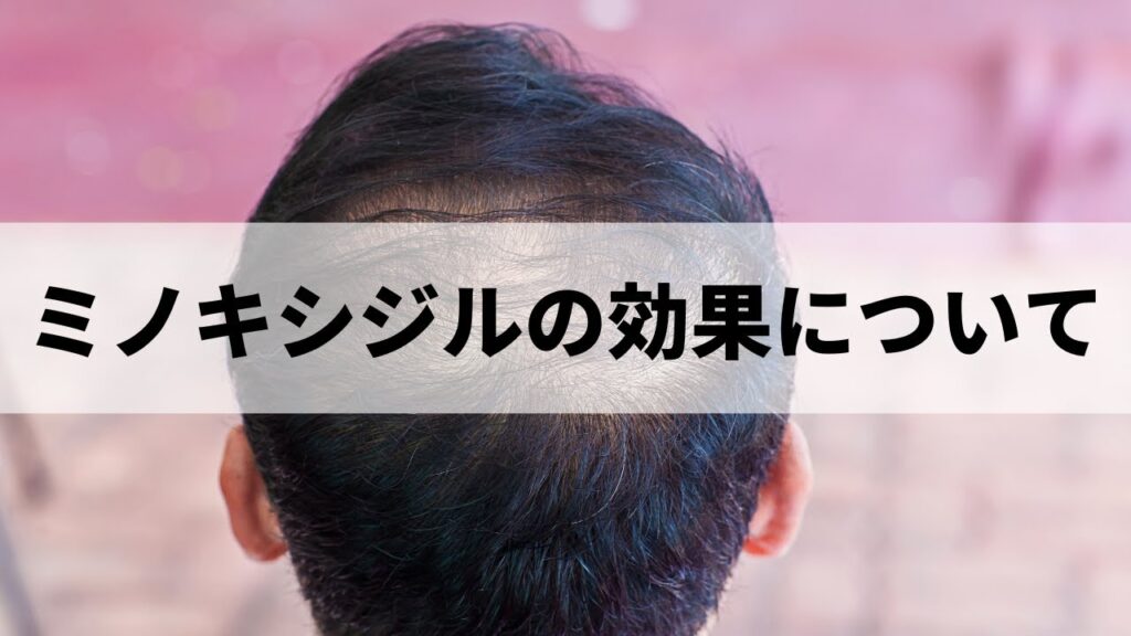 ミノキシジル完全ガイド2024: 効果、使用法、副作用 | 薄毛治療のすべて