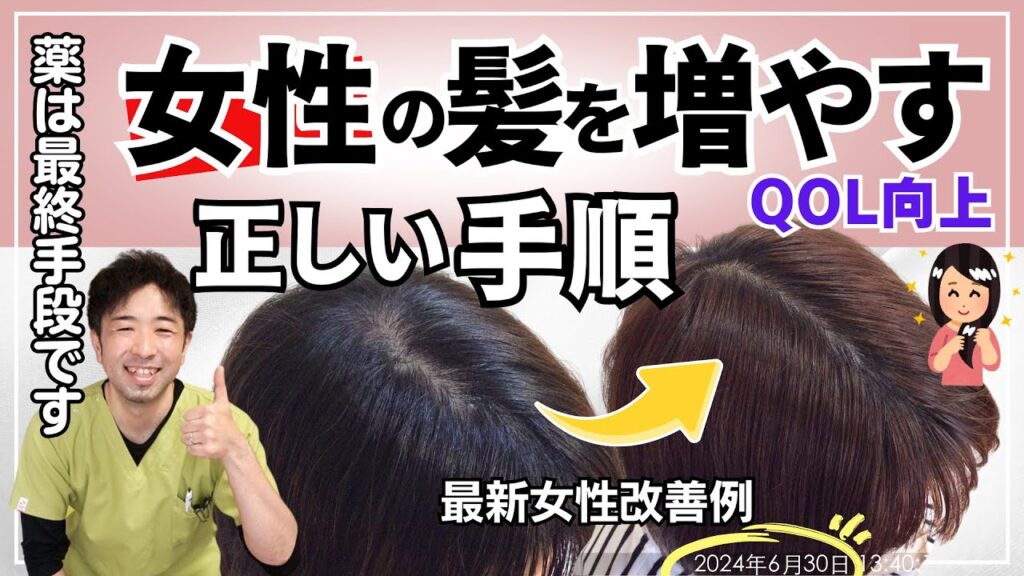 【重要】確実に女性の薄毛を改善する為の4つのステップ【育毛に最適なゴールデンホホバオイル紹介】