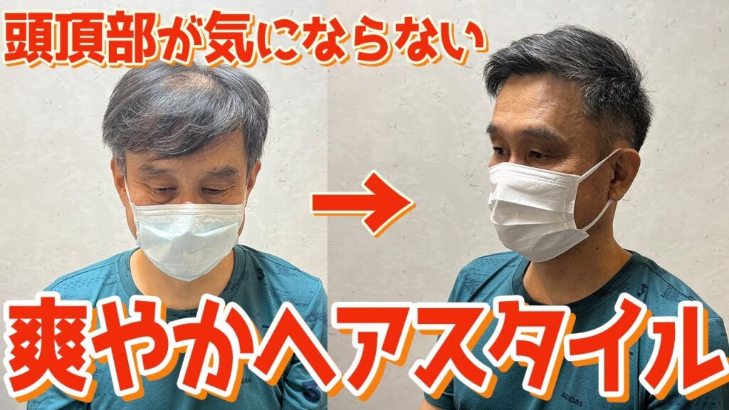 頭頂部の薄毛が気になるモデルさんをカットとセットで大変身させていく！