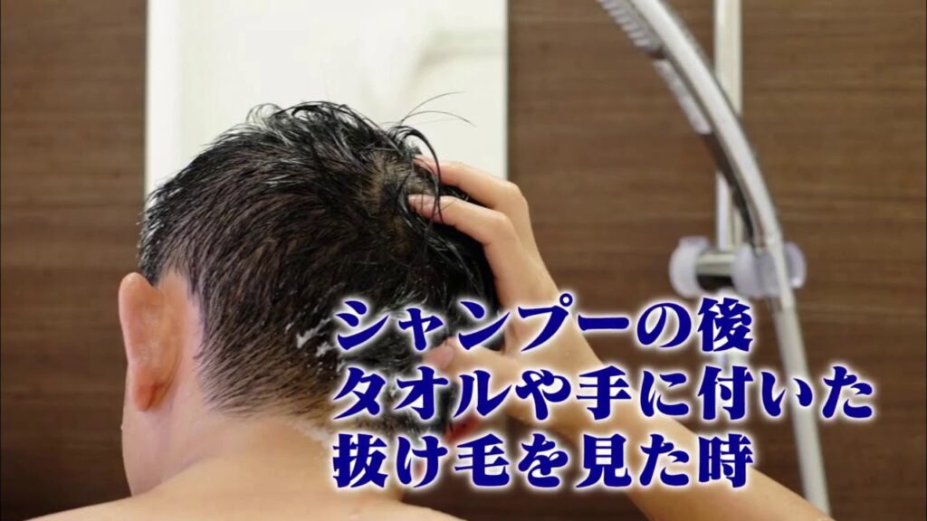 自毛植毛 で 薄毛 を根本解決。 親和クリニック TV放送分（その3）