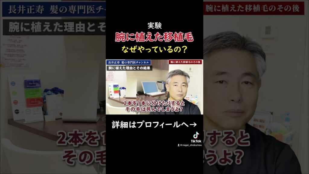 第3回 腕の毛の植毛の状況をご紹介します#shorts