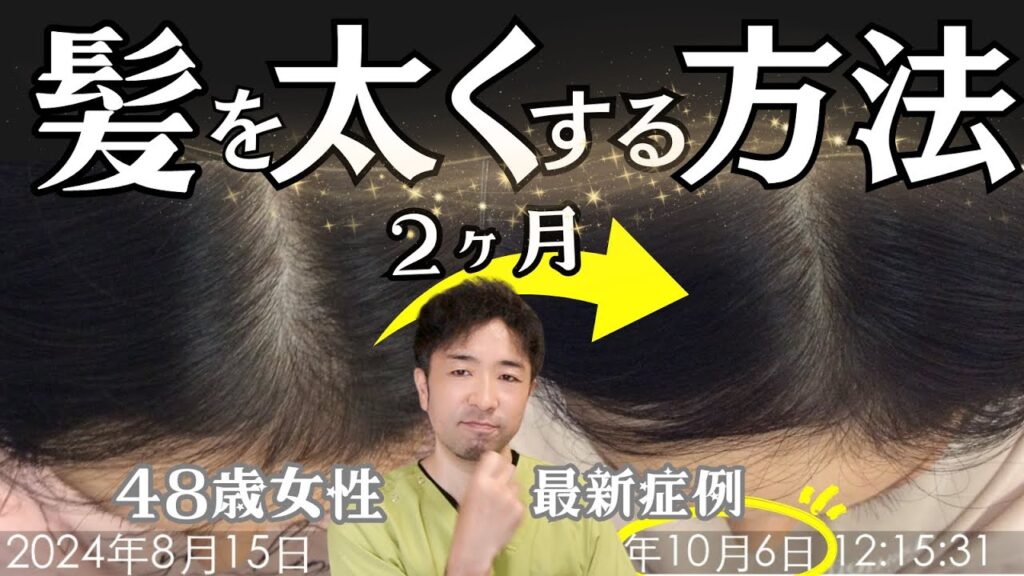 【48歳女性発毛症例】薬やサプリよりまずはコレ！女性の薄毛の根本原因&セルフケア2選