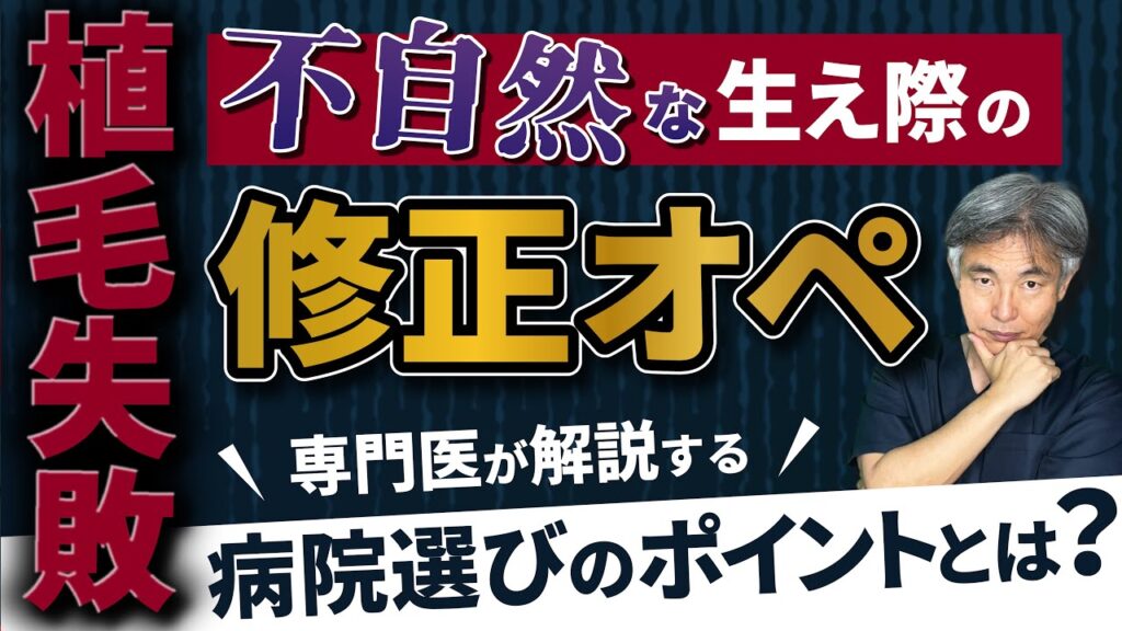 【植毛業界の闇】他院でFUE手術に失敗 長井式なら修正できるのか?他院1600グラフトで失敗 当院約1000グラフトで挑戦