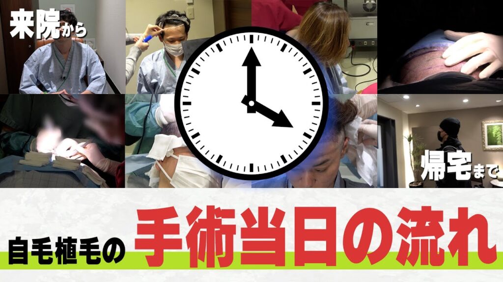 【薄毛治療】植毛当日の流れを専門医が徹底解説！【自毛植毛】【植毛】
