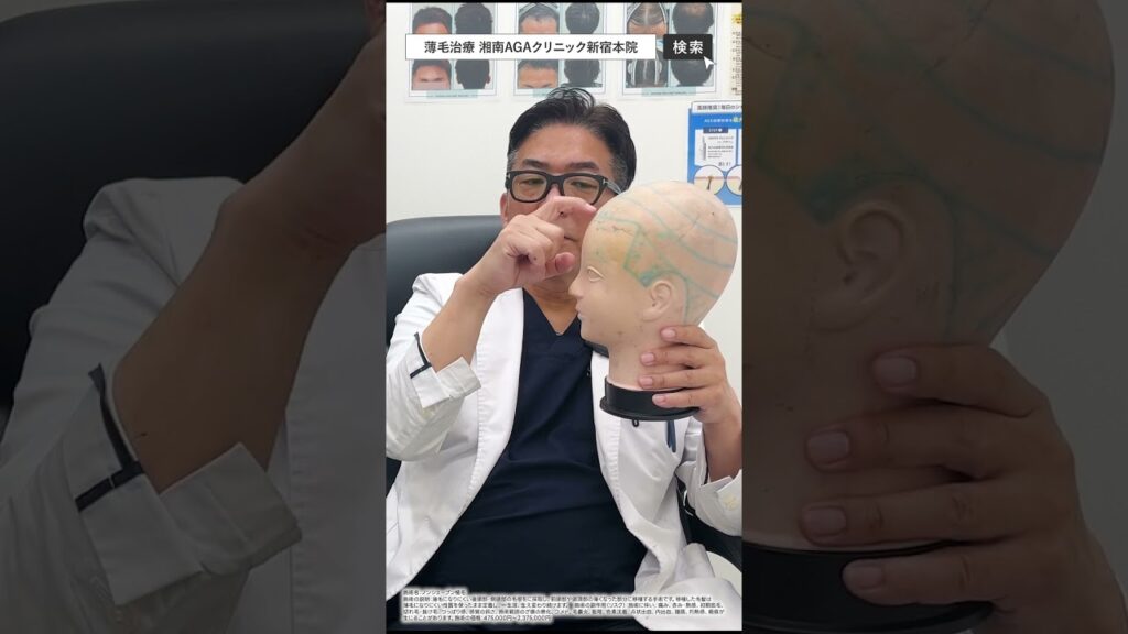 30代男性：生え際・M字のボリュームダウンが気になっている方の治療解説 #aga治療＃自毛植毛