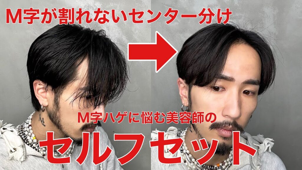 【M字ハゲ必見！】M字でも割れないセンターパート
