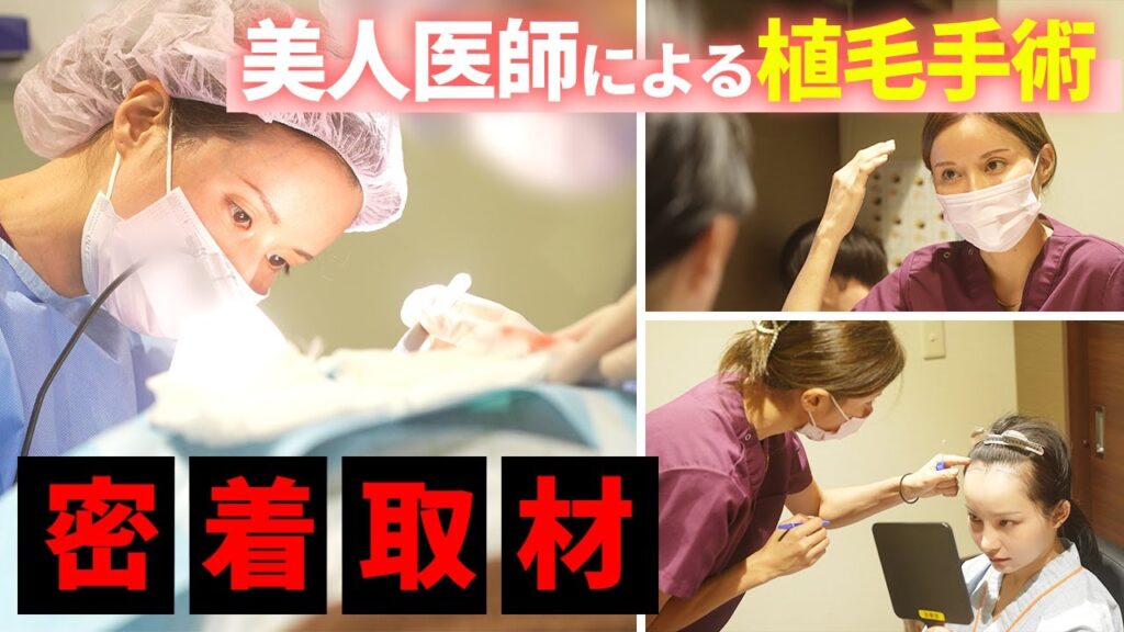 【自毛植毛】藤井先生の植毛手術に密着！！【薄毛】【AGA治療】
