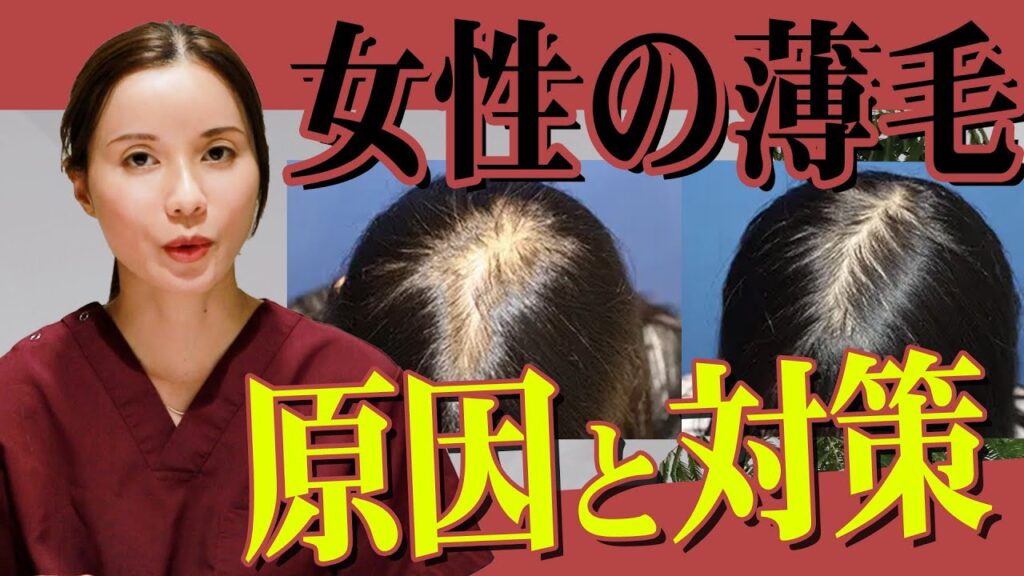 【自毛植毛】女性の薄毛の原因を専門医が解説！！【薄毛】【AGA治療】