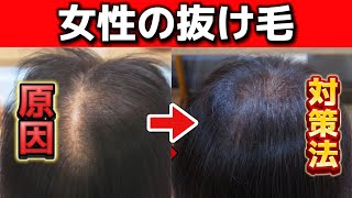【抜け毛がひどい方必見】女性の抜け毛の原因と対策の方法
