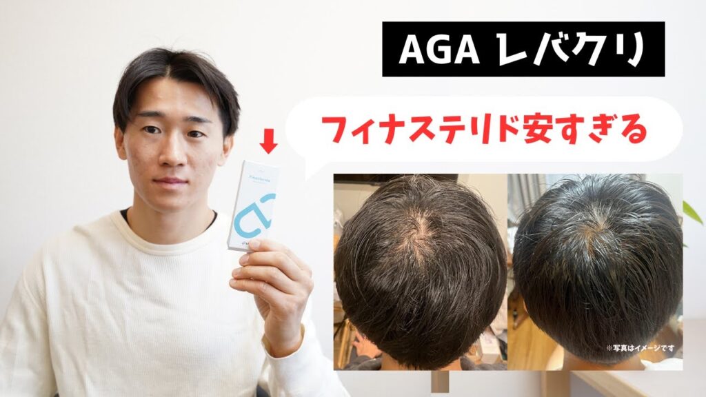 【AGA治療】レバクリが破格すぎる… オンラインクリニックのここがすごい!