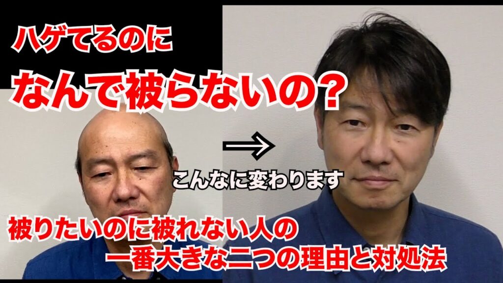 ハゲているのにカツラを着けない人は沢山いますが、何故なんでしょうね?被ったらこんなに変わるのに…