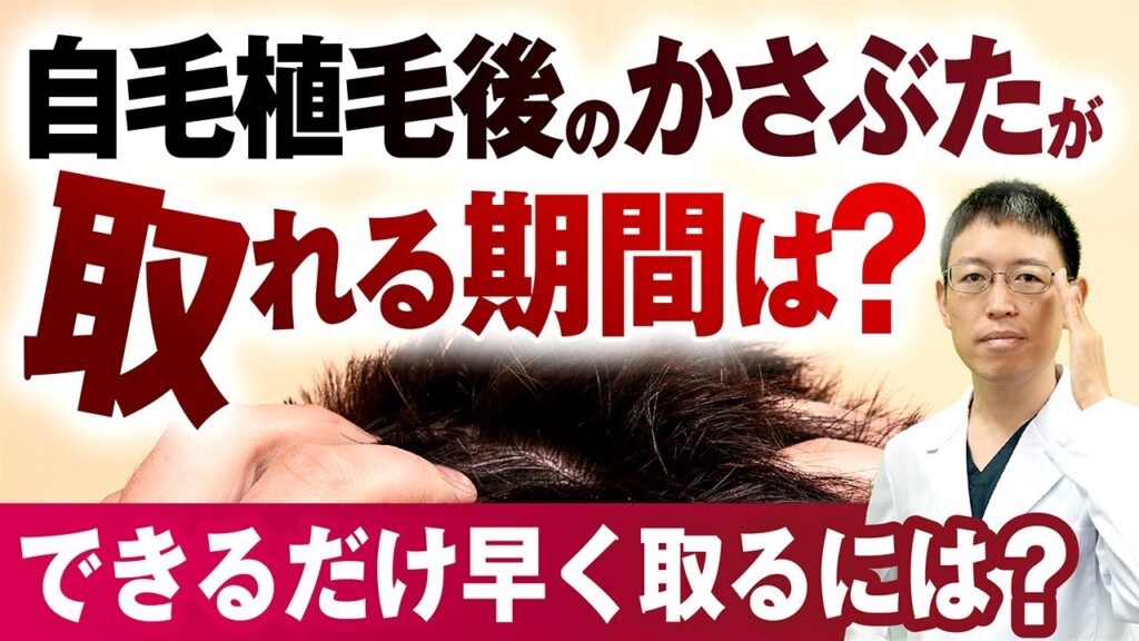 【長谷川誠医師が解説】自毛植毛後のかさぶたが取れる期間は?できるだけ早く取る方法はある?