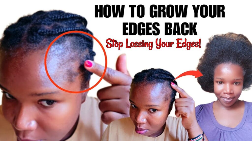 REGROW YOUR EDGES BACK FAST! Fix Balding & Thinning Edges Naturally