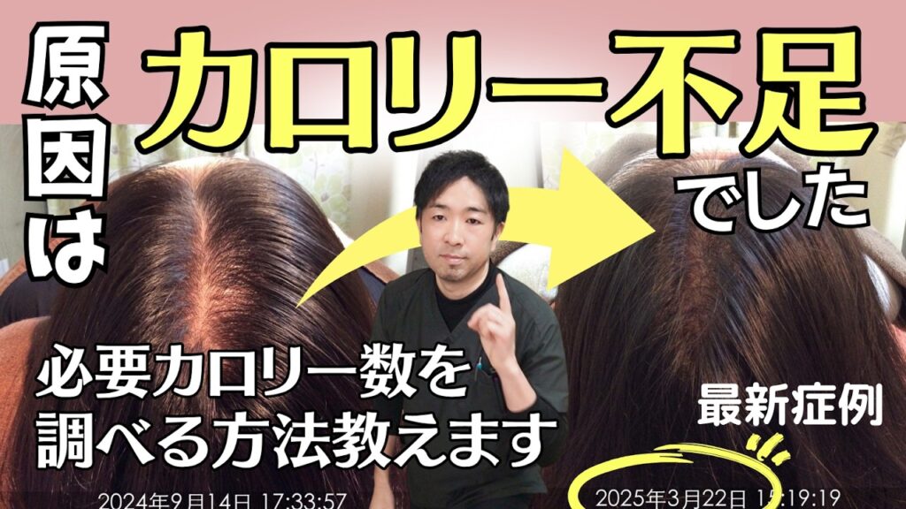 【女性の薄毛の原因】育毛はエネルギー依存!つまり食事量が足りていないんです。