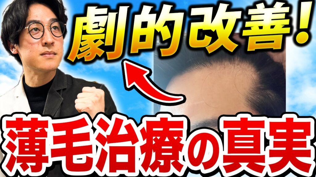 【後悔する前に】薄毛を止めるAGA薬4選と入手先の落とし穴|薬剤師が薄毛治療の真実をお話しします