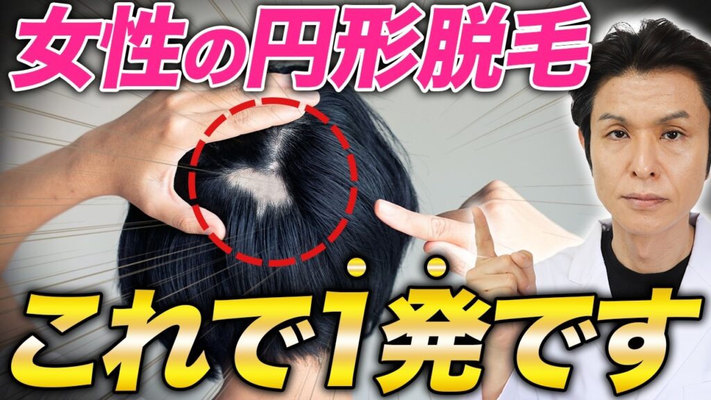 【円形脱毛症】突然の抜け毛に注意！原因・治療・再発予防を徹底解説皮膚科専門医が語る「円形脱毛症」の正体とは？