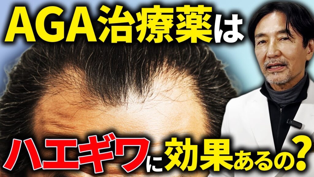 フィナステリド、ミノキシジルはM字生え際に効果ある？専門医が徹底解説
