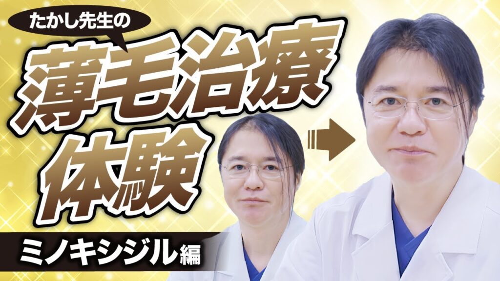 【薄毛】実際に医師が薄毛治療を体験してみた!その効果と副作用を徹底解説!!【ミノキシジル編】